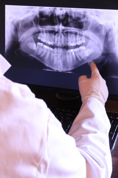 Best Chipped Tooth Repair Near Me  in Ballwin, MO